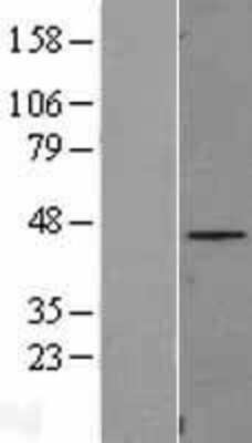 Western Blot: FAM110B Overexpression Lysate [NBL1-10444]