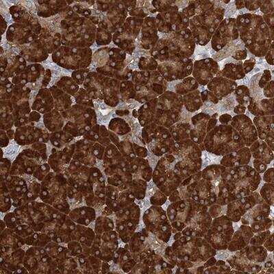 Immunohistochemistry: FAM110C Antibody [NBP1-90908]