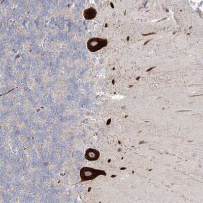 Immunohistochemistry: FAM110C Antibody [NBP2-38284]