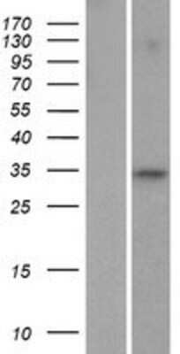 Western Blot: FAM110C Overexpression Lysate [NBP2-08466]