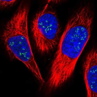 Immunocytochemistry/ Immunofluorescence: FAM111A Antibody [NBP1-82103]