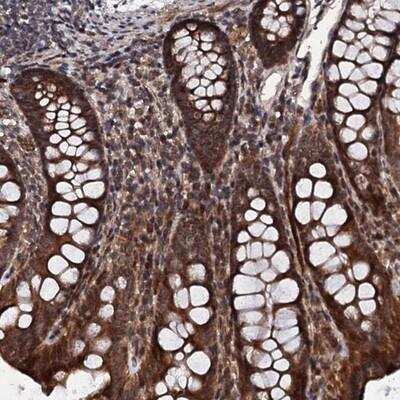 Immunohistochemistry-Paraffin: FAM111A Antibody [NBP1-82104]