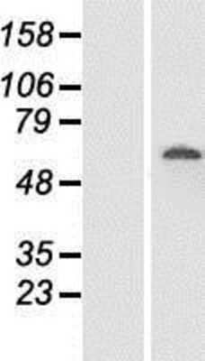 Western Blot: FAM111A Overexpression Lysate [NBP2-10085]