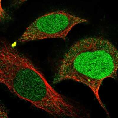 Immunocytochemistry/ Immunofluorescence: FAM111B Antibody [NBP1-86645]