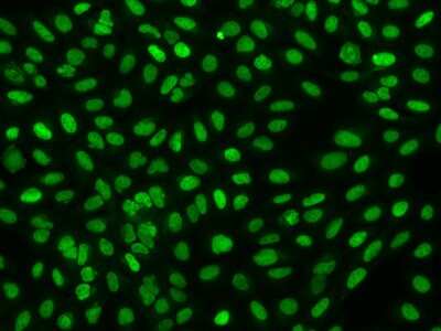 Immunocytochemistry/ Immunofluorescence: FAM111B Antibody [NBP2-97985]