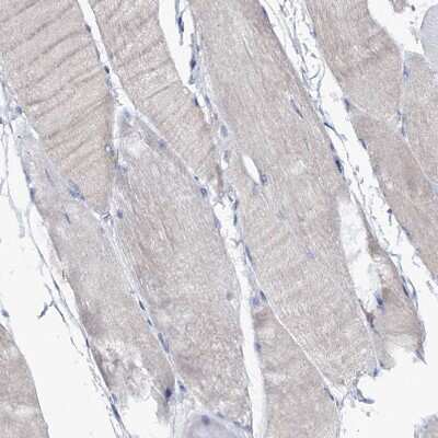 Immunohistochemistry-Paraffin: FAM111B Antibody [NBP1-86645]