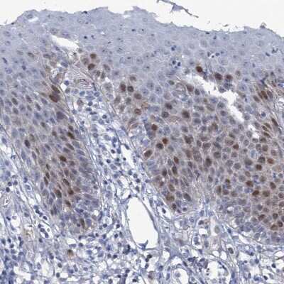 Immunohistochemistry-Paraffin: FAM111B Antibody [NBP1-86645]