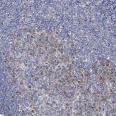 Immunohistochemistry-Paraffin: FAM111B Antibody [NBP1-86645]