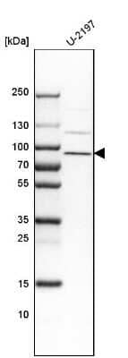 Western Blot: FAM111B Antibody [NBP1-86645]