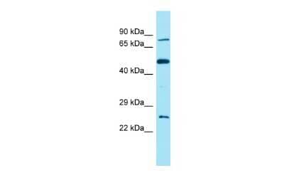 Western Blot: FAM111B Antibody [NBP2-87399]