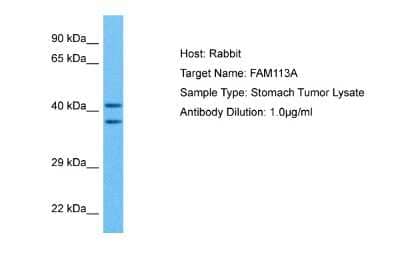 Western Blot: FAM113A Antibody [NBP2-87400]