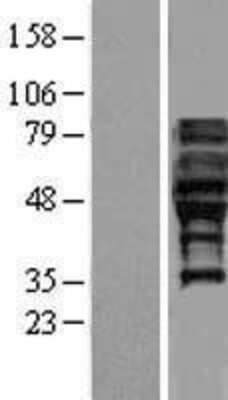 Western Blot: FAM113A Overexpression Lysate [NBL1-10447]