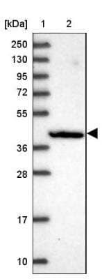 Western Blot: FAM113B Antibody [NBP1-91879]