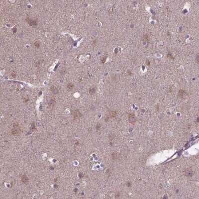 Immunohistochemistry: FAM114A1 Antibody [NBP2-49610]