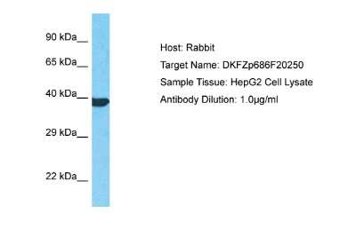 Western Blot: FAM114A1 Antibody [NBP2-87401]