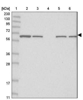 Western Blot: FAM114A2 Antibody [NBP1-89407]