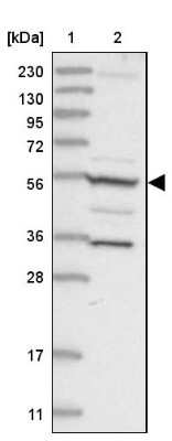 Western Blot: FAM114A2 Antibody [NBP1-89408]