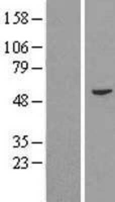 Western Blot: FAM114A2 Overexpression Lysate [NBL1-10450]