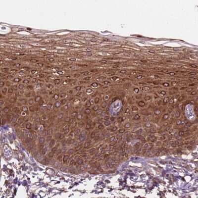 Immunohistochemistry-Paraffin: FAM115A Antibody [NBP2-48521]