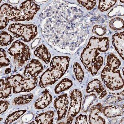 Immunohistochemistry: FAM115C Antibody [NBP1-91880]