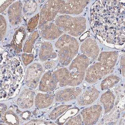 Immunohistochemistry: FAM115C Antibody [NBP1-91881]