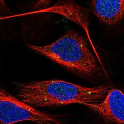 Immunocytochemistry/ Immunofluorescence: FAM116A Antibody [NBP2-57529]