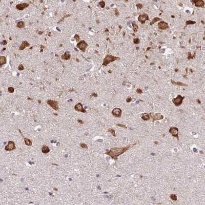 Immunohistochemistry: FAM116A Antibody [NBP2-49615]