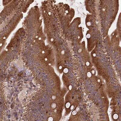 Immunohistochemistry: FAM116A Antibody [NBP2-49666]