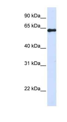 Western Blot: FAM116A Antibody [NBP1-56753]