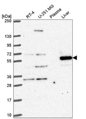 Western Blot: FAM116A Antibody [NBP2-57529]