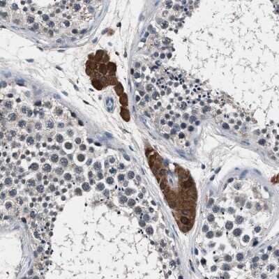 Immunohistochemistry-Paraffin: FAM116B Antibody [NBP1-81110]