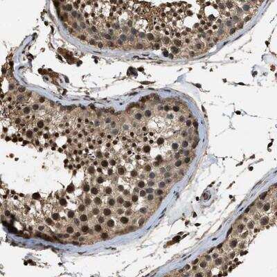 Immunohistochemistry-Paraffin: FAM116B Antibody [NBP1-81111]