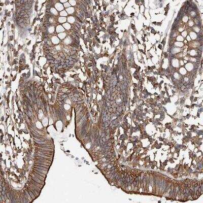 Immunohistochemistry-Paraffin: FAM116B Antibody [NBP1-81112]