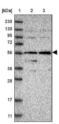 Western Blot: FAM116B Antibody [NBP1-81110]