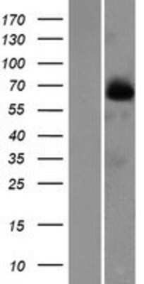 Western Blot: FAM116B Overexpression Lysate [NBP2-08957]