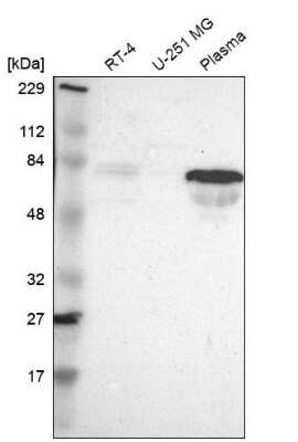 Western Blot: FAM117B Antibody [NBP1-90861]