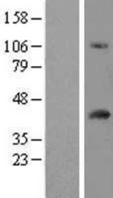 Western Blot: FAM118A Overexpression Lysate [NBL1-10452]