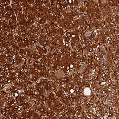 Immunohistochemistry-Paraffin: FAM118B Antibody [NBP1-93958]