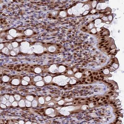 Immunohistochemistry-Paraffin: FAM118B Antibody [NBP1-93959]