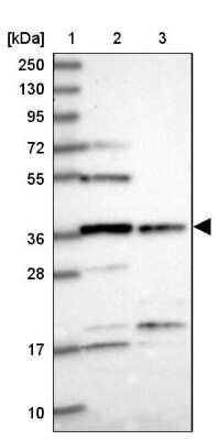 Western Blot: FAM118B Antibody [NBP1-93959]