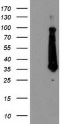 Western Blot: FAM119A Antibody (OTI2G7) [NBP2-01334]