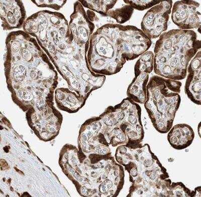 Immunohistochemistry-Paraffin: FAM119A Antibody [NBP1-83282]