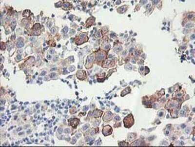 Immunohistochemistry: FAM119A Antibody (OTI2G7) - Azide and BSA Free [NBP2-72423]