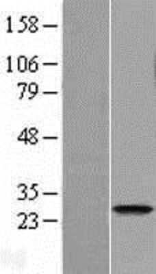 Western Blot: FAM119A Overexpression Lysate [NBL1-10454]