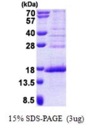 SDS-PAGE: Recombinant Human FAM119A His Protein [NBP2-23232]