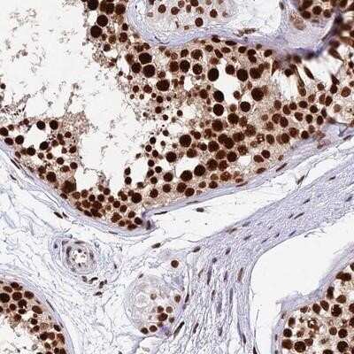 Immunohistochemistry-Paraffin: FAM119B Antibody [NBP2-14233]