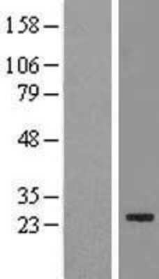 Western Blot: FAM119B Overexpression Lysate [NBL1-10455]