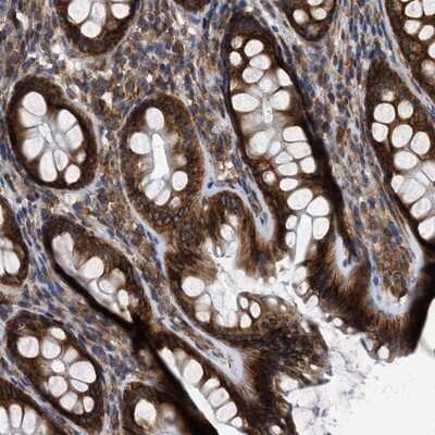 Immunohistochemistry-Paraffin: FAM120A Antibody [NBP1-86715]