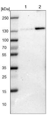 Western Blot: FAM120A Antibody [NBP1-86715]