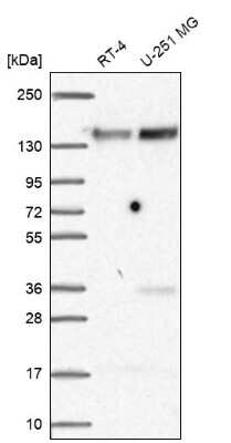 Western Blot: FAM120A Antibody [NBP2-38771]